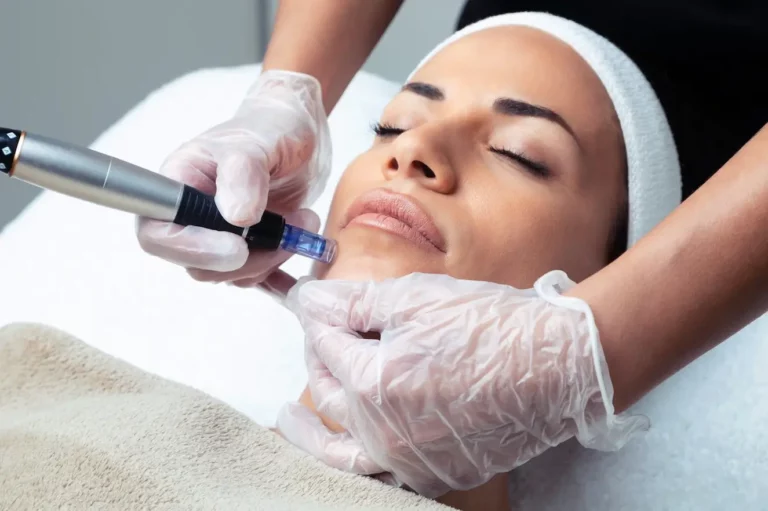 The Ultimate Guide to CIT Skin Treatment: Is it Right for You?