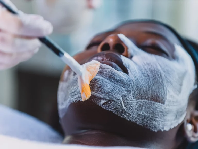 The 5 Best Chemical Peels for Hyperpigmentation on Black Skin: A Comprehensive Guide
