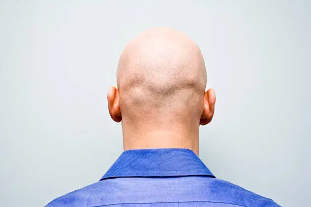 How to Get Even Skin Tone on Bald Head: Exploring the 8 Ways