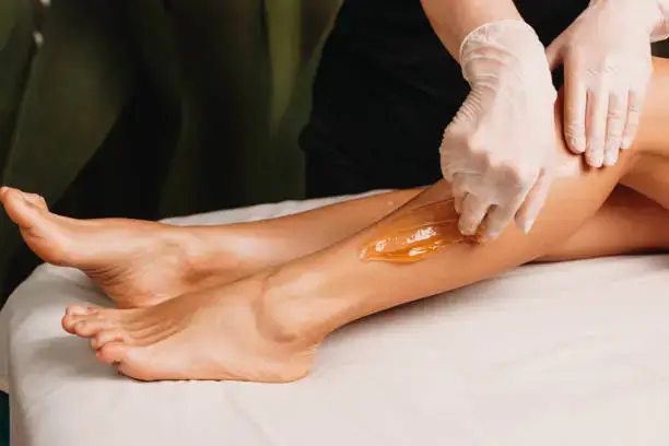 Does Waxing Cause Hyperpigmentation