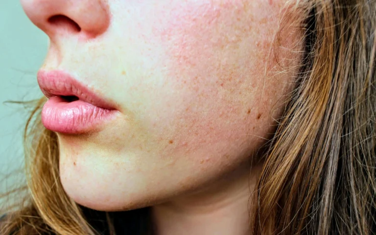 Sensitive Skin 101: How to Identify, Treat, and Prevent Irritation